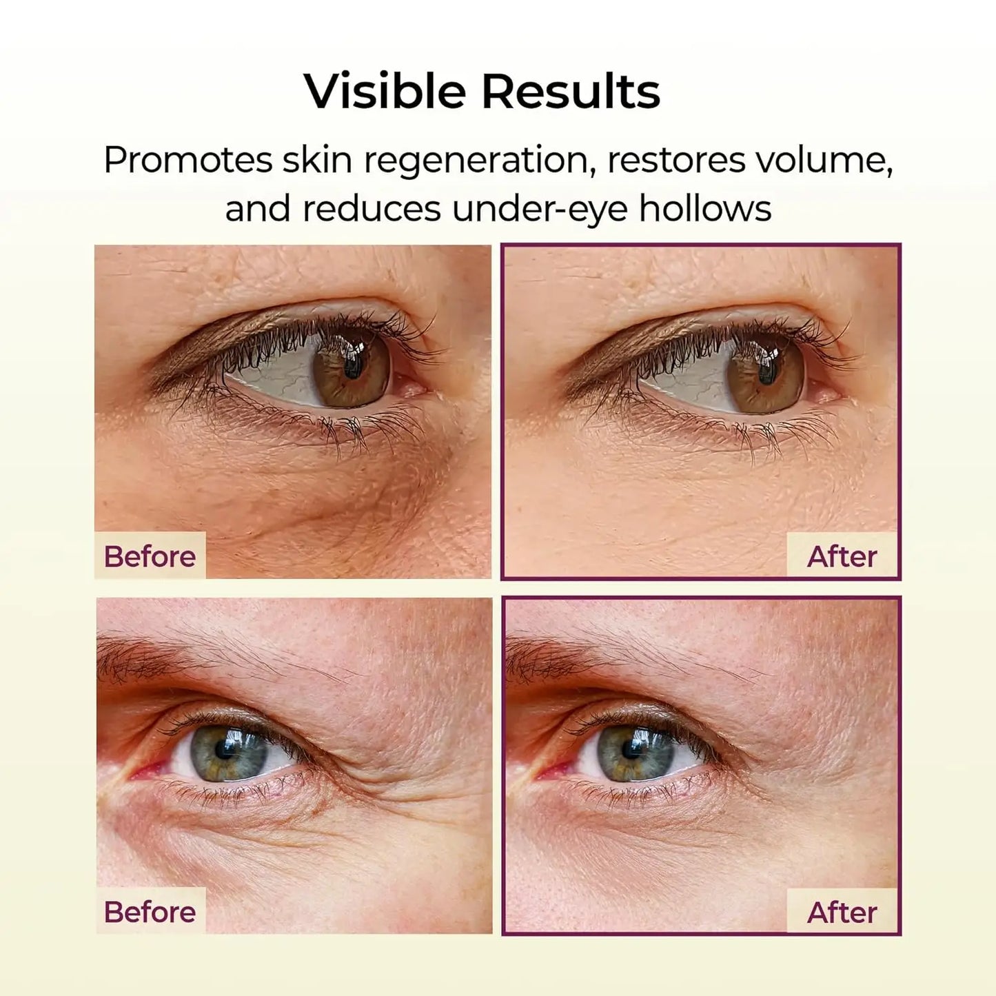 Calcium Multi Balm 9g All In One Wrinkles Calcium Volume Multi Balm Stick Collagen Wrinkles Face Eye treatment Balm calcium