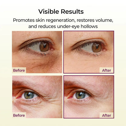 Calcium Multi Balm 9g All In One Wrinkles Calcium Volume Multi Balm Stick Collagen Wrinkles Face Eye treatment Balm calcium