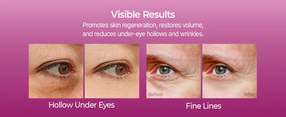 Calcium Multi Balm 9g All In One Wrinkles Calcium Volume Multi Balm Stick Collagen Wrinkles Face Eye treatment Balm calcium